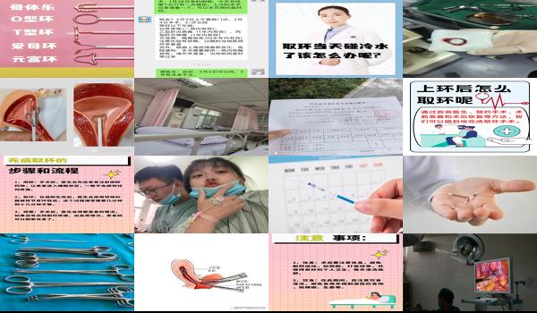 取环多久可以跳绳 - 汕头取环几天可以跳绳