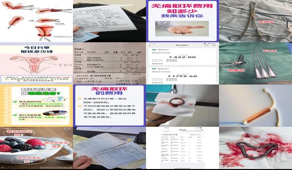 汕头女人取环多少钱一次 - 汕头女人取环多少钱